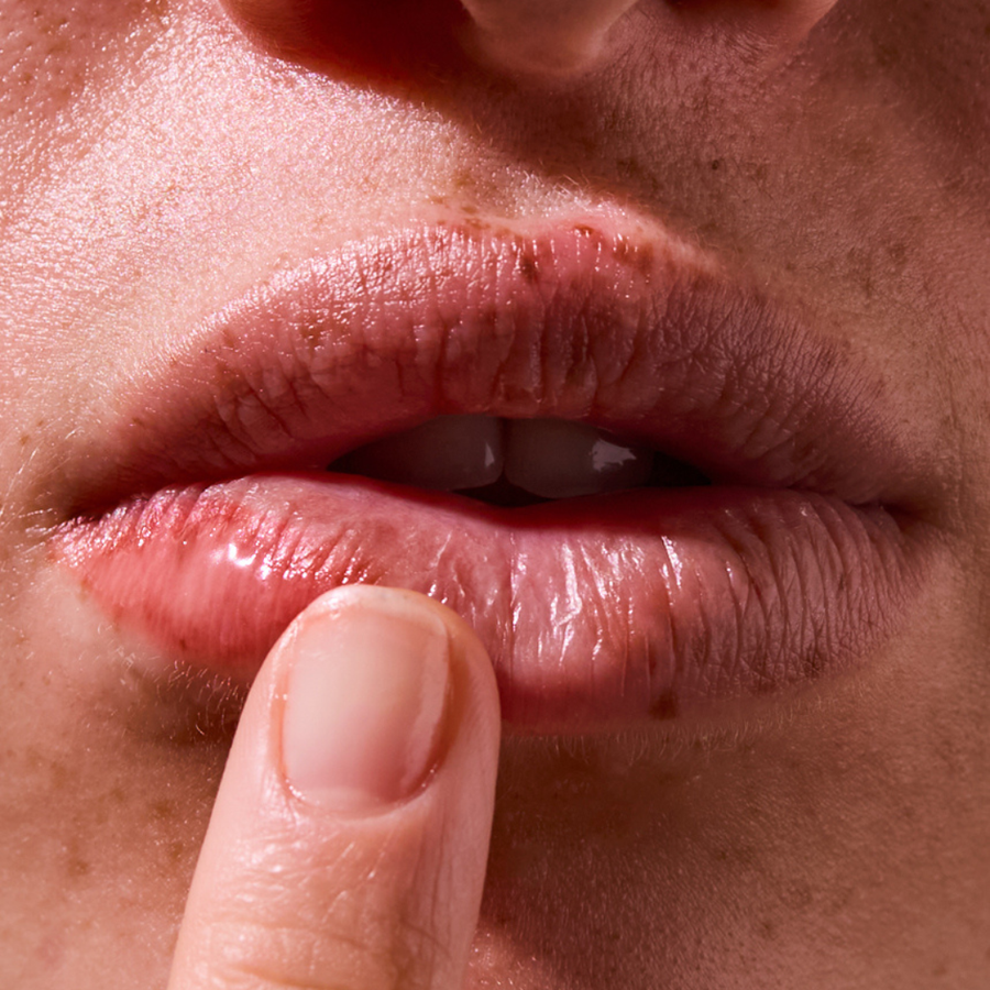 All-Purpose Moisture Balm