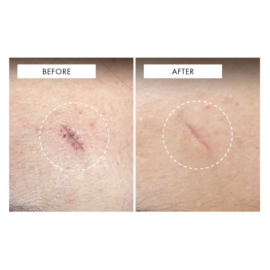 111SKIN Repair Serum NAC Y2