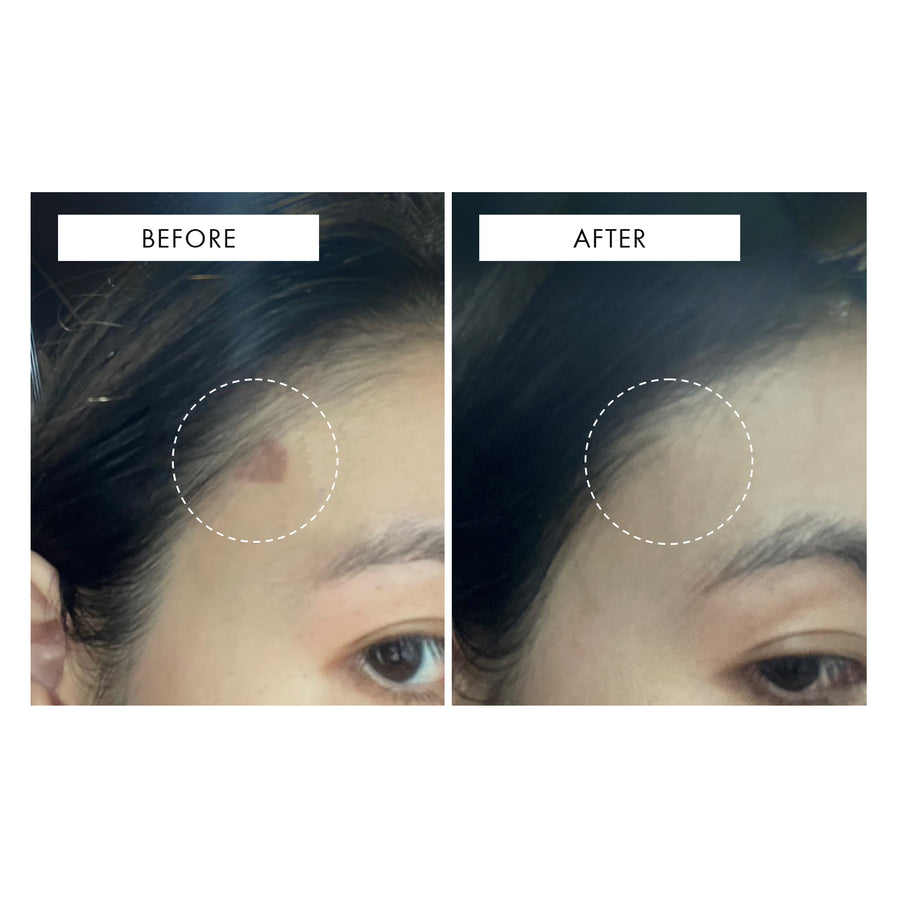 111SKIN Repair Serum NAC Y2