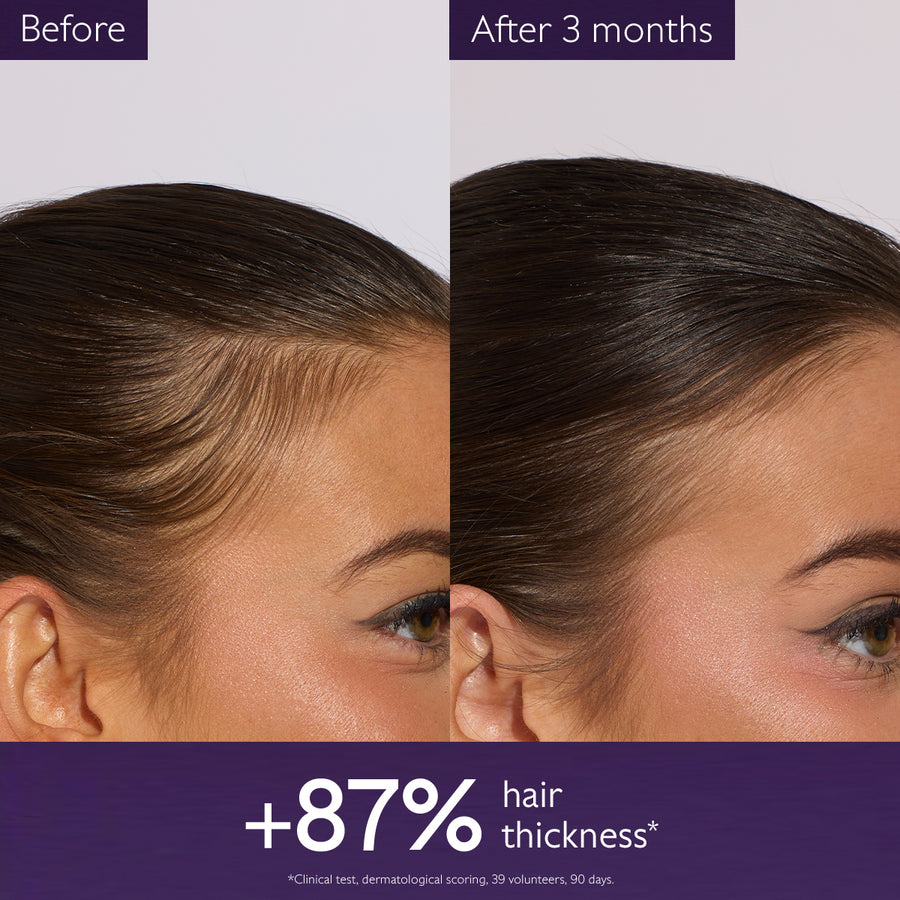 Anti-Hair Loss Serum