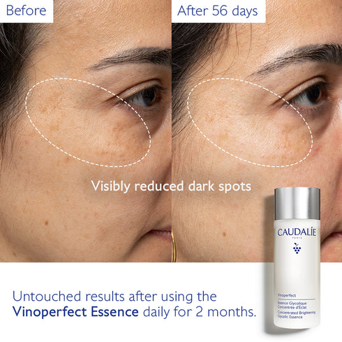 Vinoperfect Concentrated Brightening Glycolic Essence