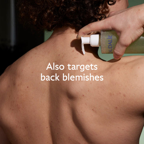 Vinopure Purifying Gel Cleanser with Salicylic Acid