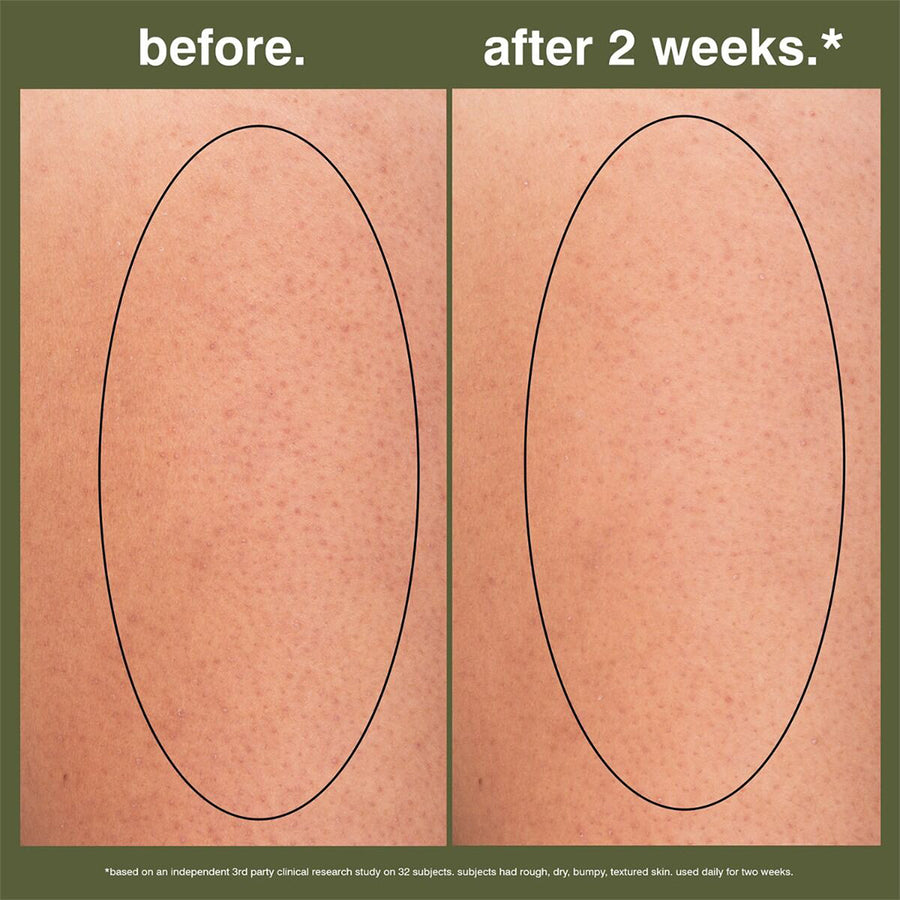 body gel serum