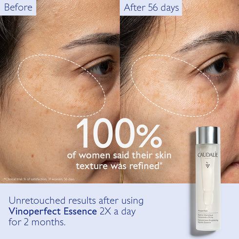 VINOPERFECT BRIGHTENING GLYCOLIC ESSENCE