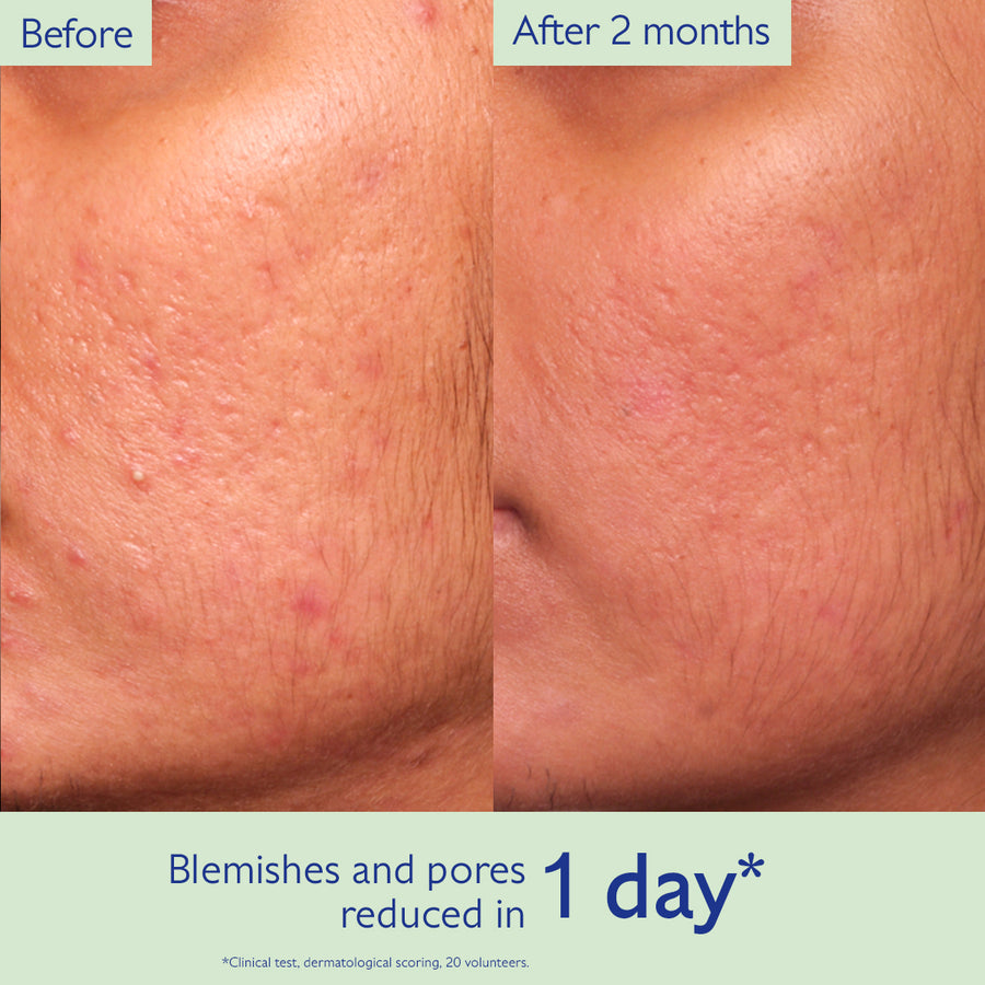 Vinopure  Blemish Control Salicylic Acid Serum