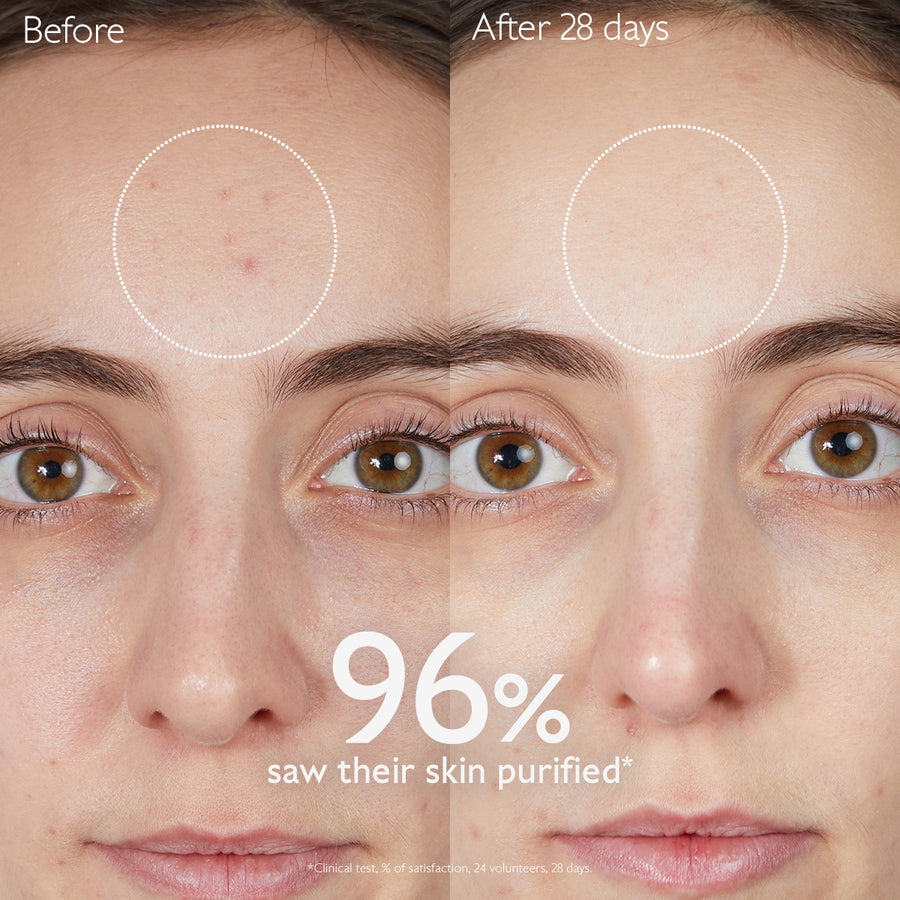 Anti-Blemish Duo