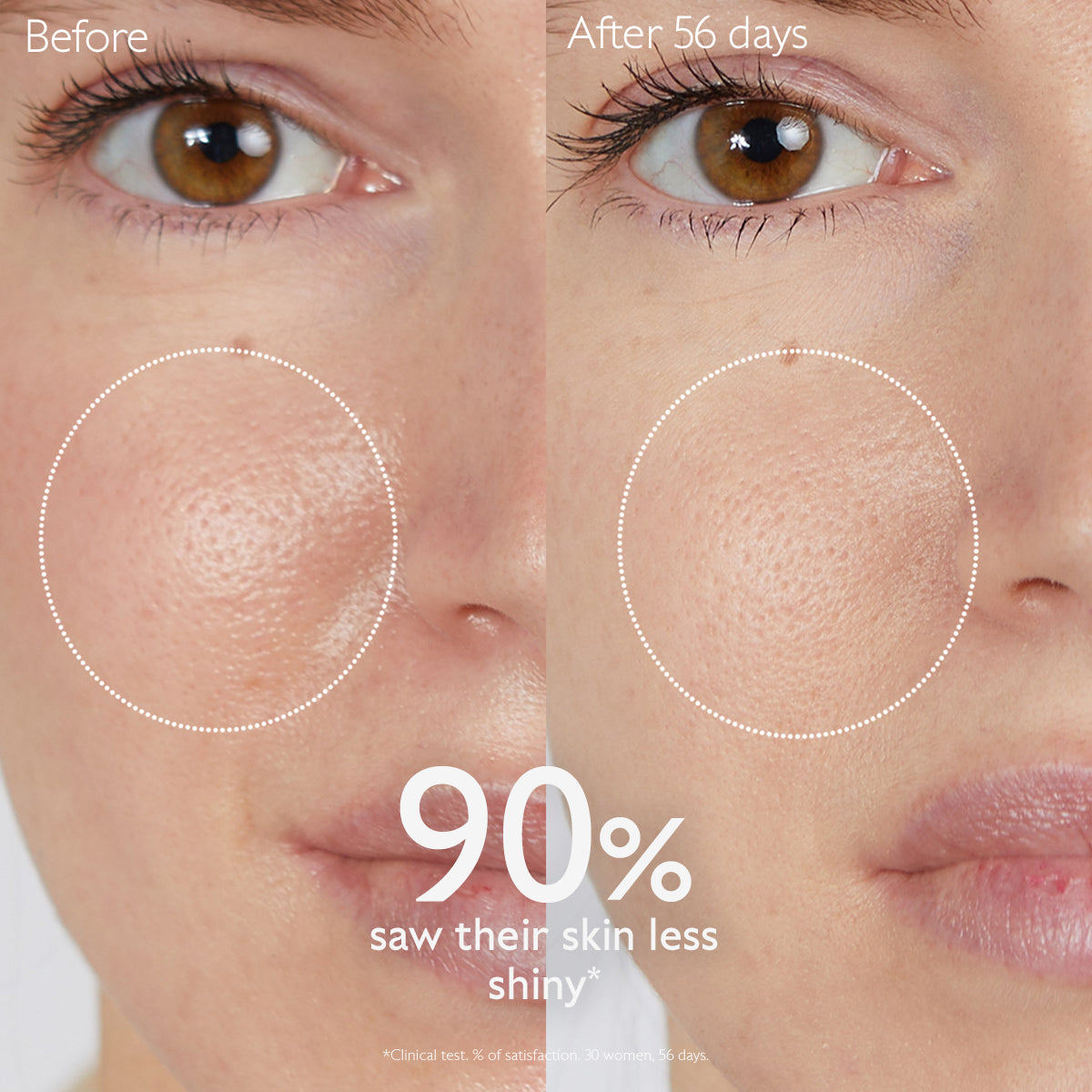 caudalie-vinopure-lotion-before-after-using