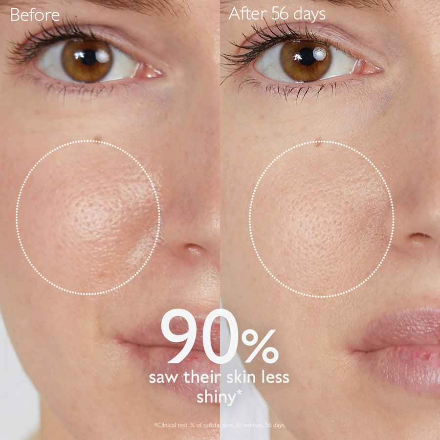 caudalie-vinopure-lotion-before-after-using