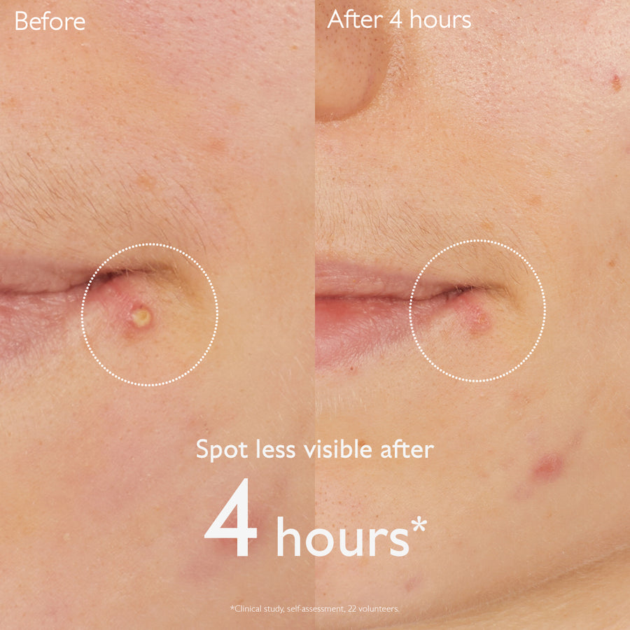 before-after-using-vinopure-stop-bouton