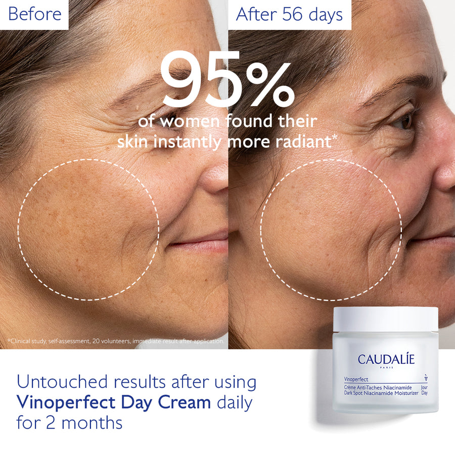 Vinoperfect Dark Spot Niacinamide Moisturizer