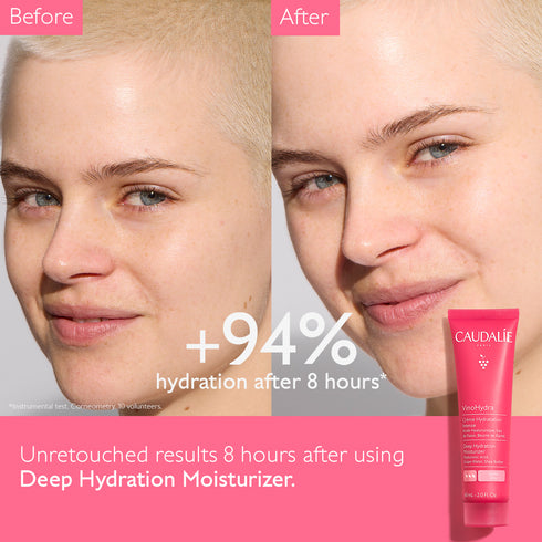 VINOHYDRA DEEP HYDRATION MOISTURIZER