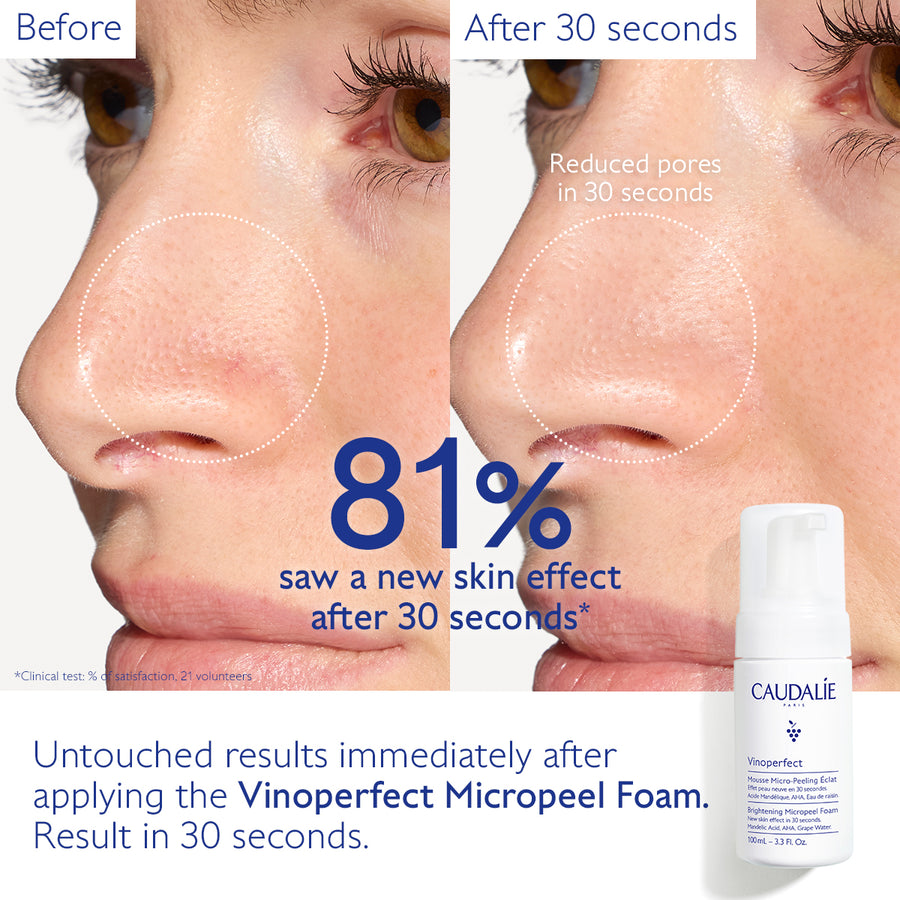 Vinoperfect Instant Brightening Micropeel