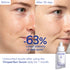 VINOPERFECT SERUM & SUNCARE SET