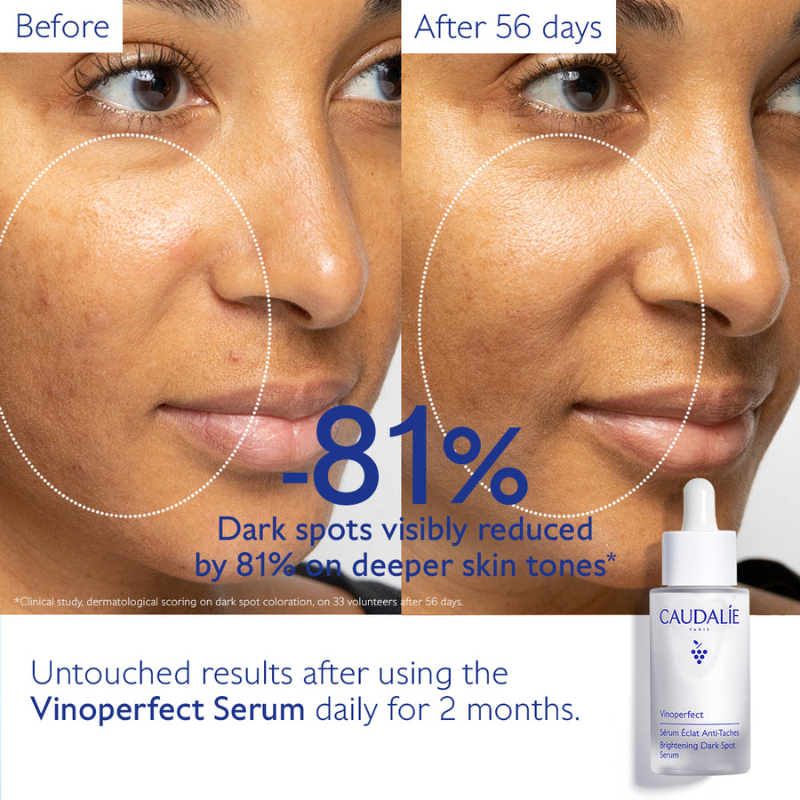 Vinoperfect Serum & Suncare Set