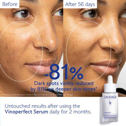 VINOPERFECT SERUM & SUNCARE SET