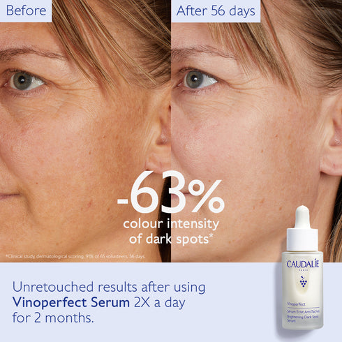 VINOPERFECT BRIGHTENING DARK SPOT SERUM