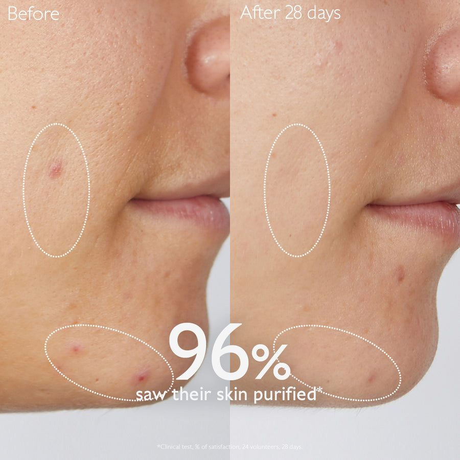 before-after-using-caudalie-vinopure-gelee