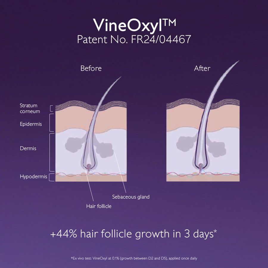 Anti-Hair Loss Serum